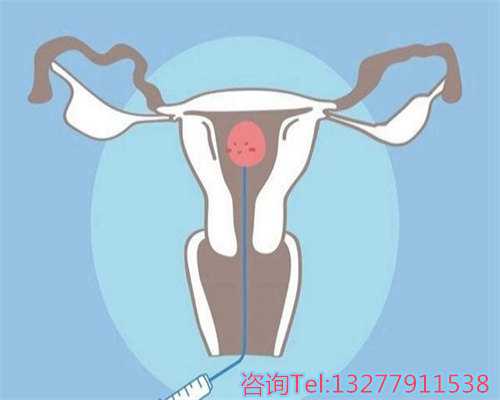 硒酵母：提高生育质量与挑选购买技巧