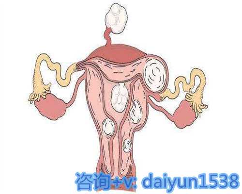 武汉有偿捐卵联系,精选方案：孝感哪里看不孕不育最出名？